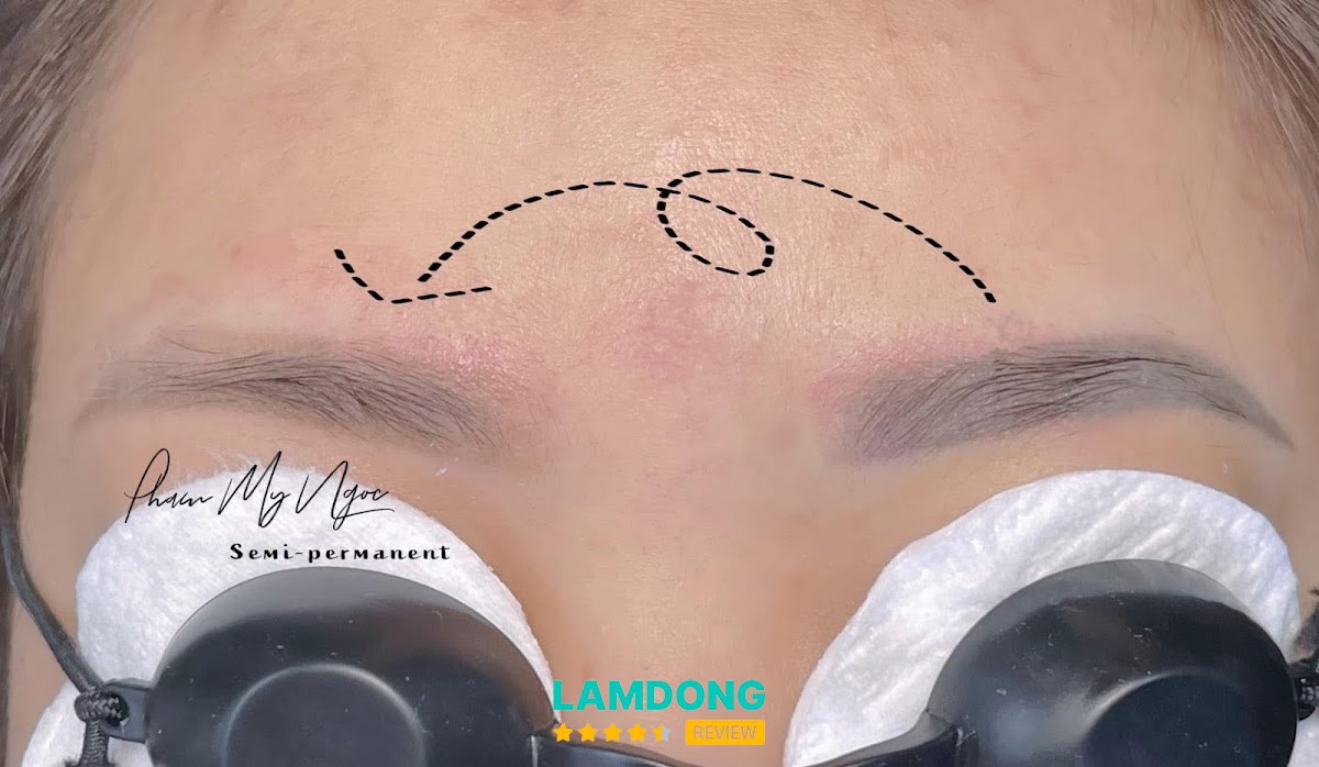 Phạm Mỹ Ngọc Đà Lạt – khử thâm môi